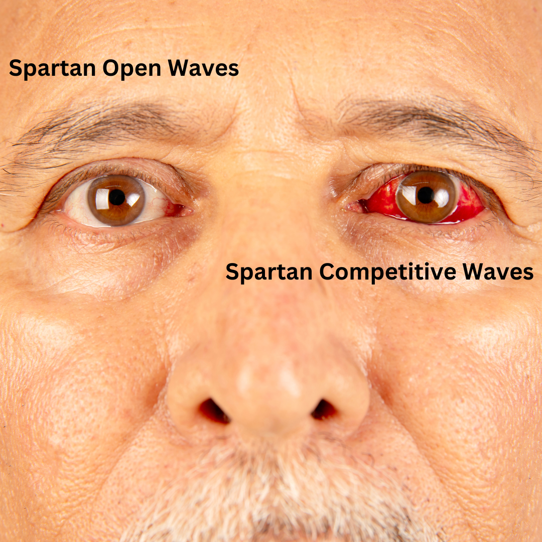 Well Folks, Spartan Race Competition is Bleeding